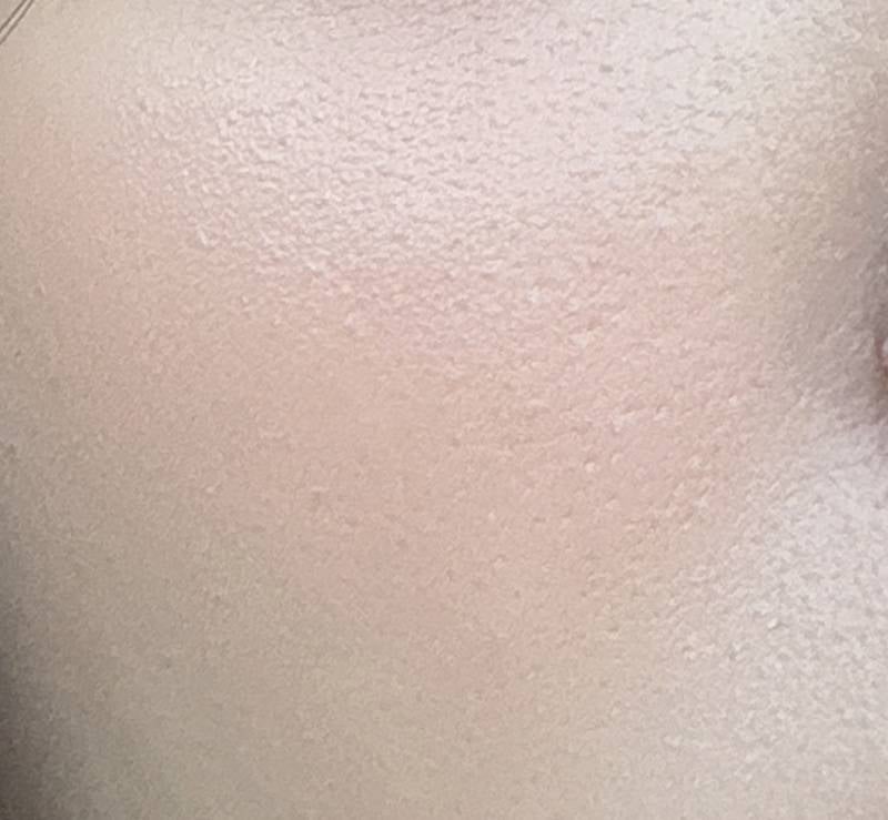 [잡담] 이런게 요철이야?? ㅠ 피부가 너무 더러워짐 | 인스티즈