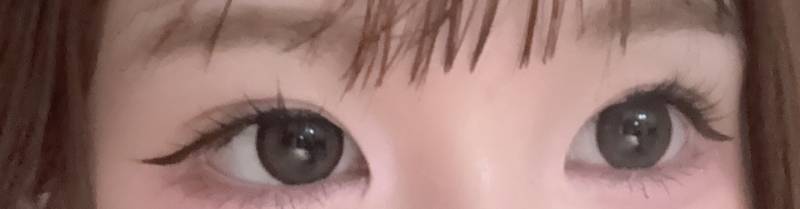 [잡담] 나 한쪽 눈만 앞트임 하면 삐꾸될까..?ㅠㅠㅠㅠ | 인스티즈