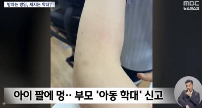 [잡담] 유치원생이 물건 던졌는데 교사가 팔잡앗다고 징역6개월이래 | 인스티즈