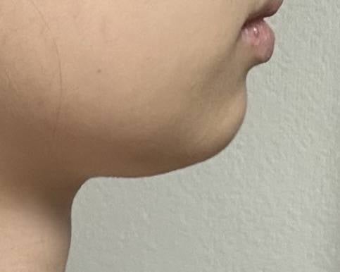 [잡담] 하관 왜 이렇게 된거야 | 인스티즈