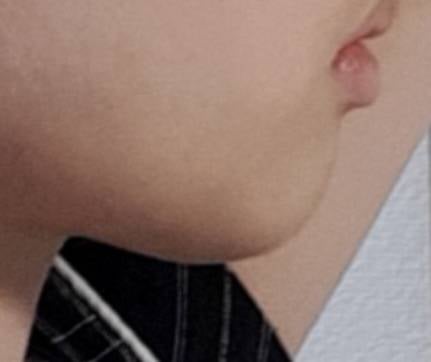 [잡담] 하관 왜 이렇게 된거야 | 인스티즈