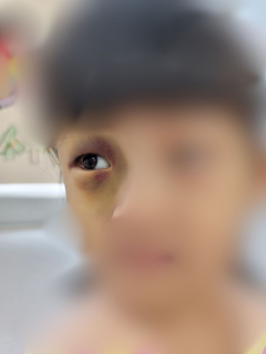 7세 아이 온몸 멍들고 골절…학대 빠지고 방임죄만 적용, 왜 | 인스티즈