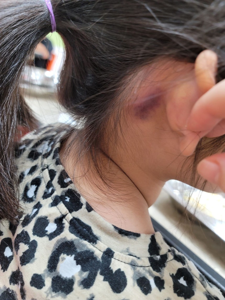 7세 아이 온몸 멍들고 골절…학대 빠지고 방임죄만 적용, 왜 | 인스티즈