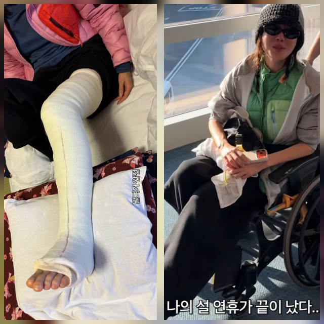 갑작스런 사고로 수술 받은 엄지원 | 인스티즈