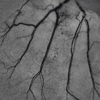 돈모아라 투자해라 이런 글은 백만싸불하면서.twt | 인스티즈