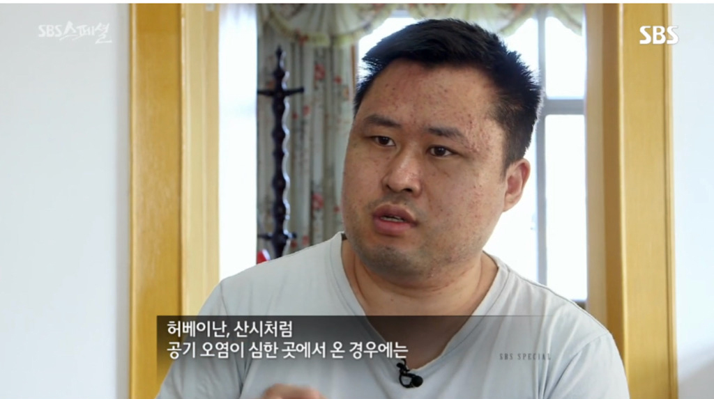 중국 현지 사례로 보는 미세먼지의 위험성.jpg | 인스티즈