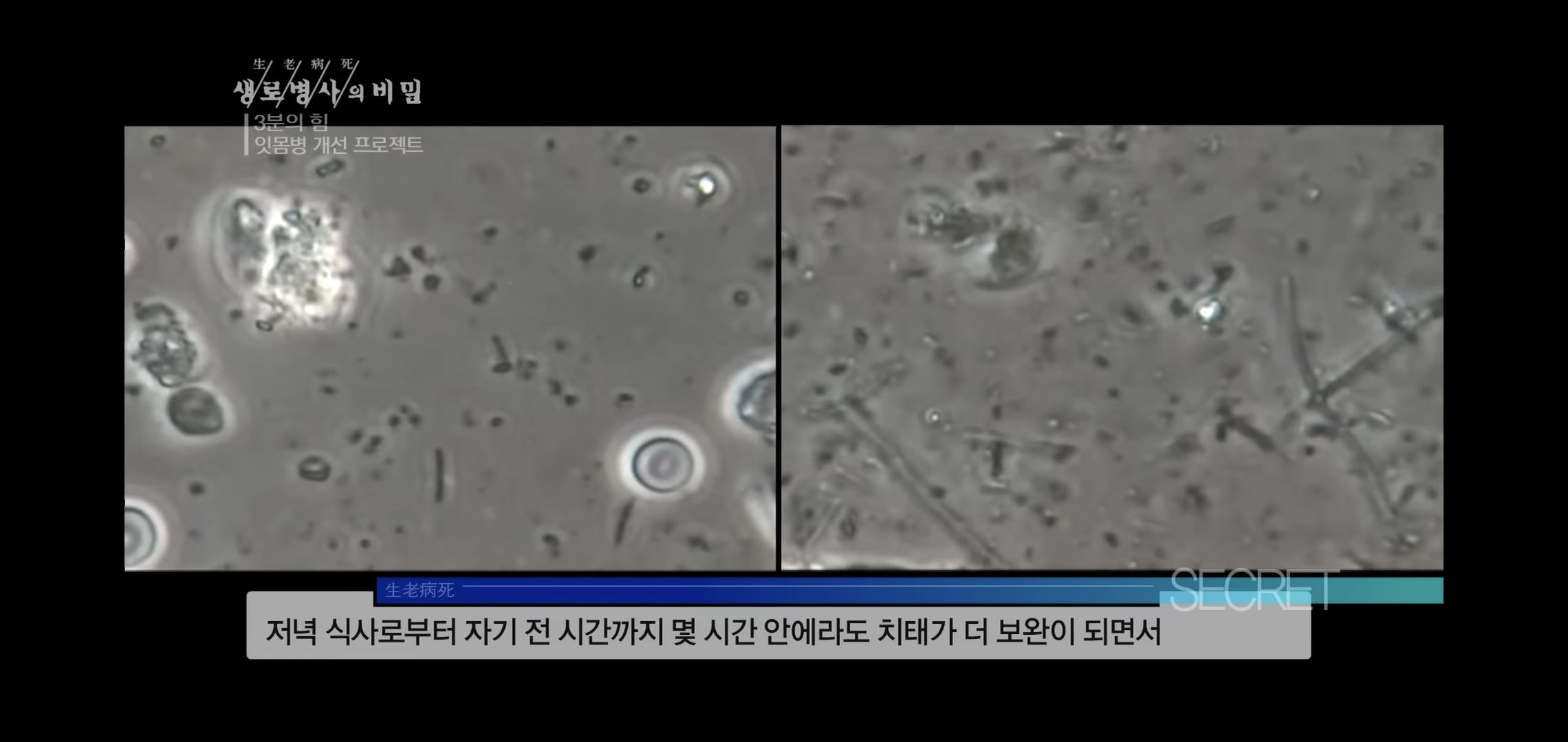 자기 직전에 양치질하는 사람들 충격적 실험 결과..jpg | 인스티즈