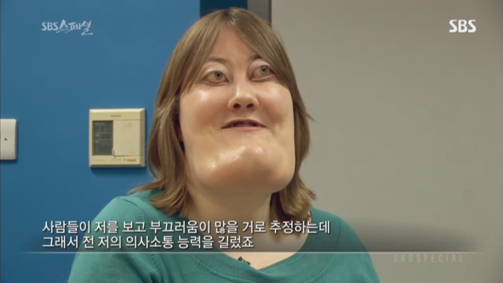 기형적 턱을 가진 여자 비키 라이트가 성형수술을 하지 않는 이유 | 인스티즈