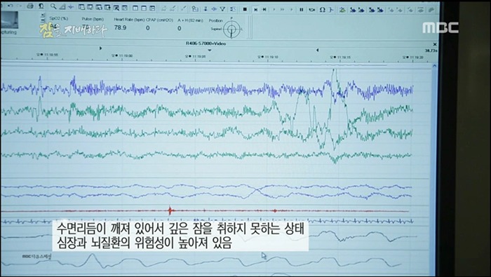 충격적인 수면의 중요성....jpg | 인스티즈