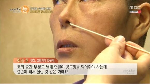 [리얼스토리눈] 15곳을 수술한 여자 내 얼굴을 찾아주세요 (성형수술 부작용) | 인스티즈