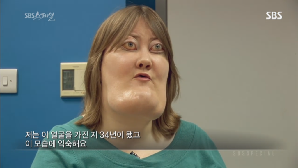 기형적 턱을 가진 여자 비키 라이트가 성형수술을 하지 않는 이유 | 인스티즈