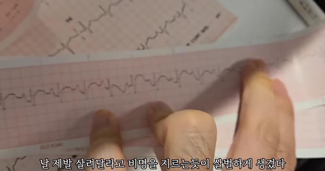 일하다가 심장마비 느낀 간호사 브이로그 | 인스티즈