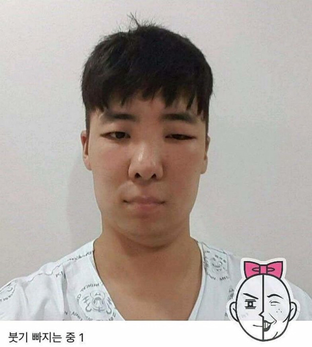 염색약 부작용 ㅎㄷㄷ(혐오주의) | 인스티즈