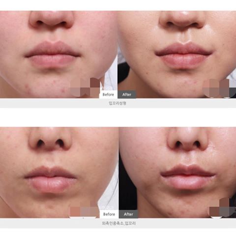 표정이 무뚝뚝하다는 소리를 많이 듣는 이유중 하나 | 인스티즈