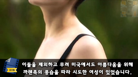 목 길이를 늘리기 위해 5년간 원주민들의 고리를 착용하고 다닌 미국인 | 인스티즈