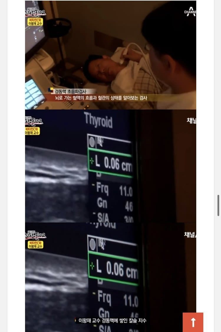 비타민C 맹신론자의 결말 | 인스티즈