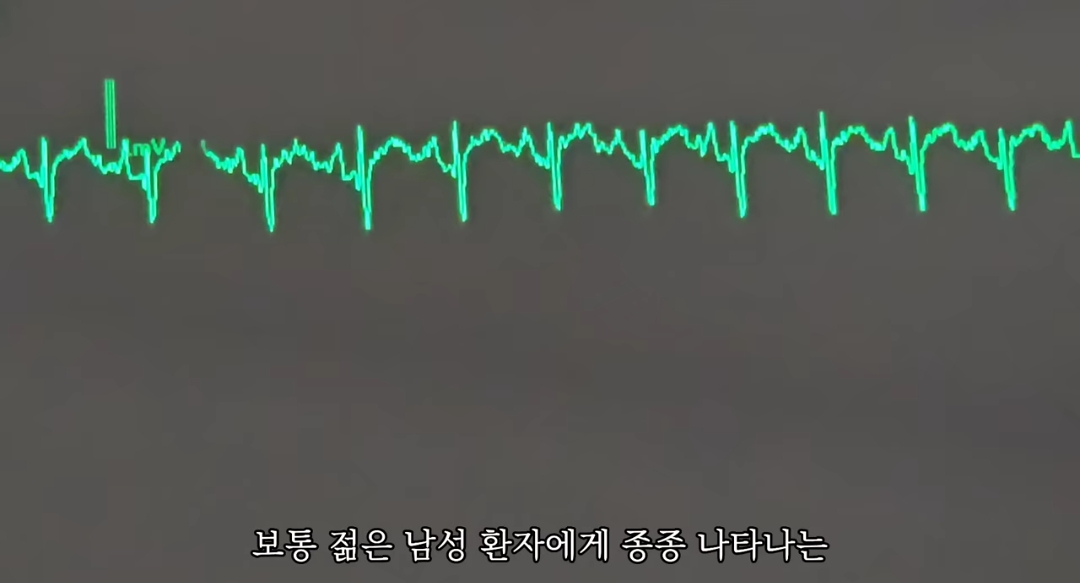 일하다가 심장마비 느낀 간호사 브이로그 | 인스티즈