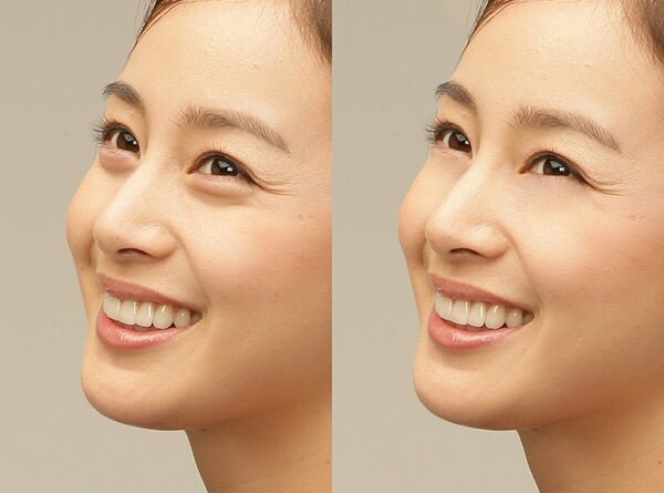 애교살이 중요한 이유 | 인스티즈