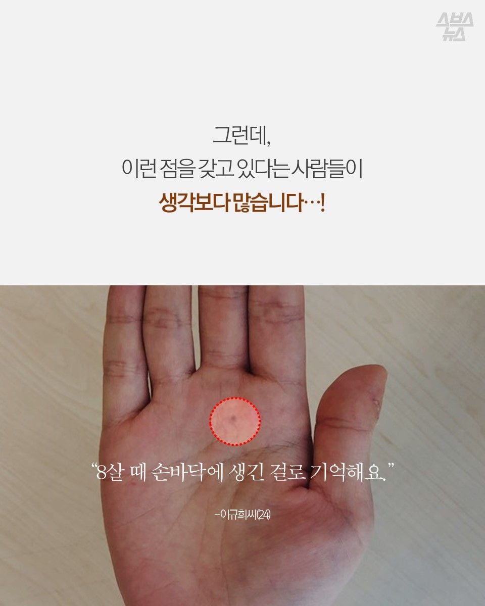 자기몸에 하나씩 있다는 연필심 점 | 인스티즈