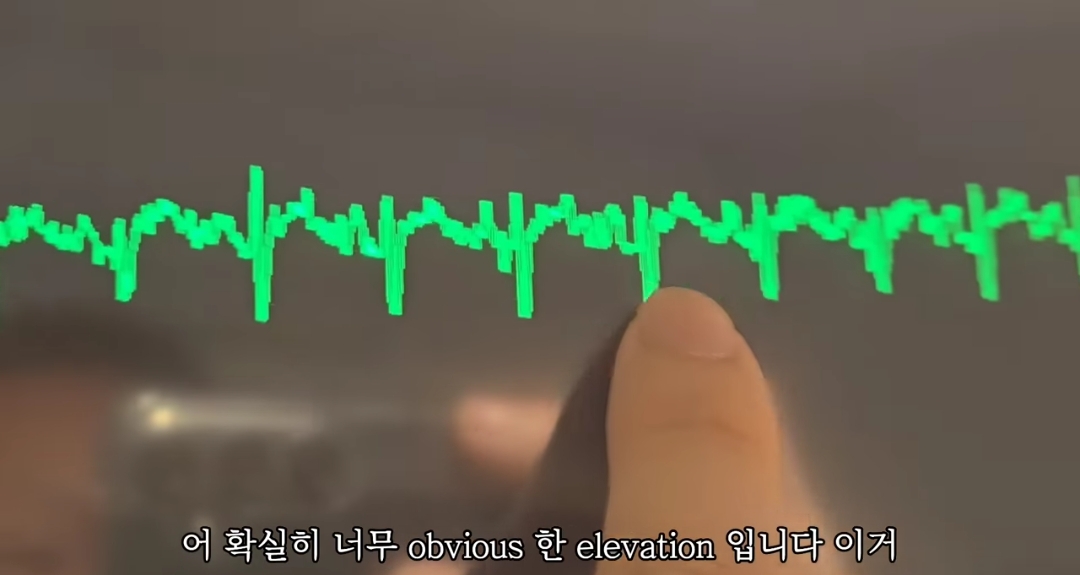 일하다가 심장마비 느낀 간호사 브이로그 | 인스티즈