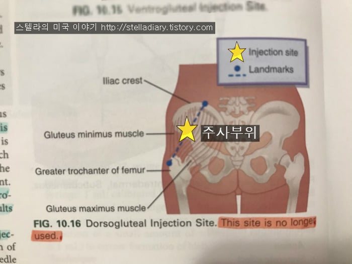 선진국에서 엉덩이에 주사를 놓지 않는 이유 | 인스티즈