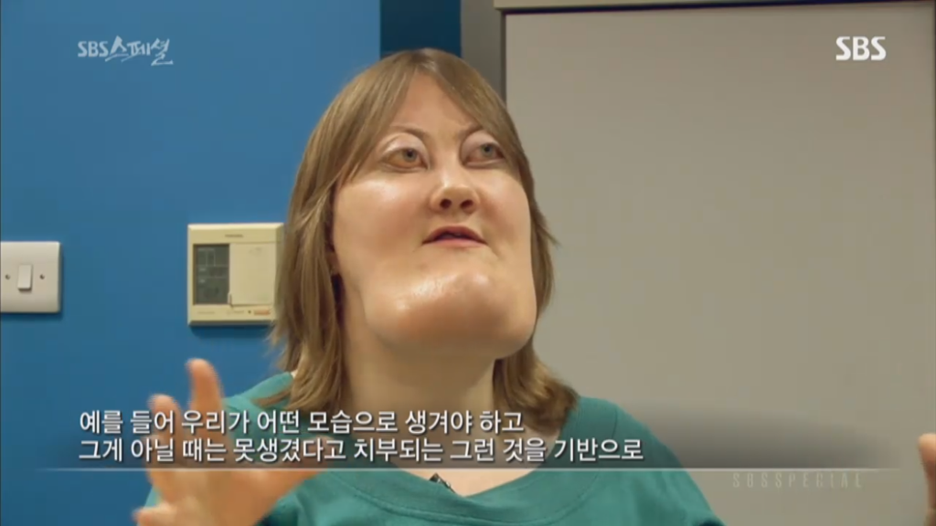 기형적 턱을 가진 여자 비키 라이트가 성형수술을 하지 않는 이유 | 인스티즈
