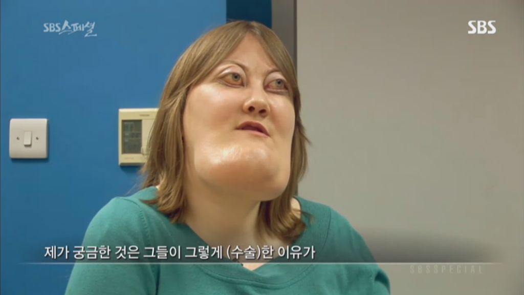 기형적 턱을 가진 여자 비키 라이트가 성형수술을 하지 않는 이유 | 인스티즈