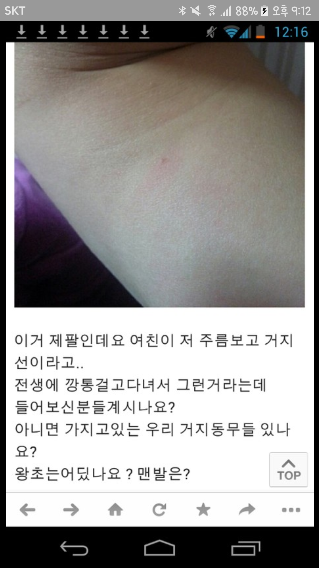 팔 안 쪽에 있는 주름 : 거지선 | 인스티즈
