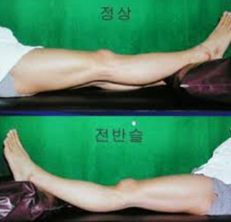 [반장슬] 다리모양 분명 이렇게 생긴 여시들 있을거야!(종아리가 뒤로 빠진 형태) | 인스티즈