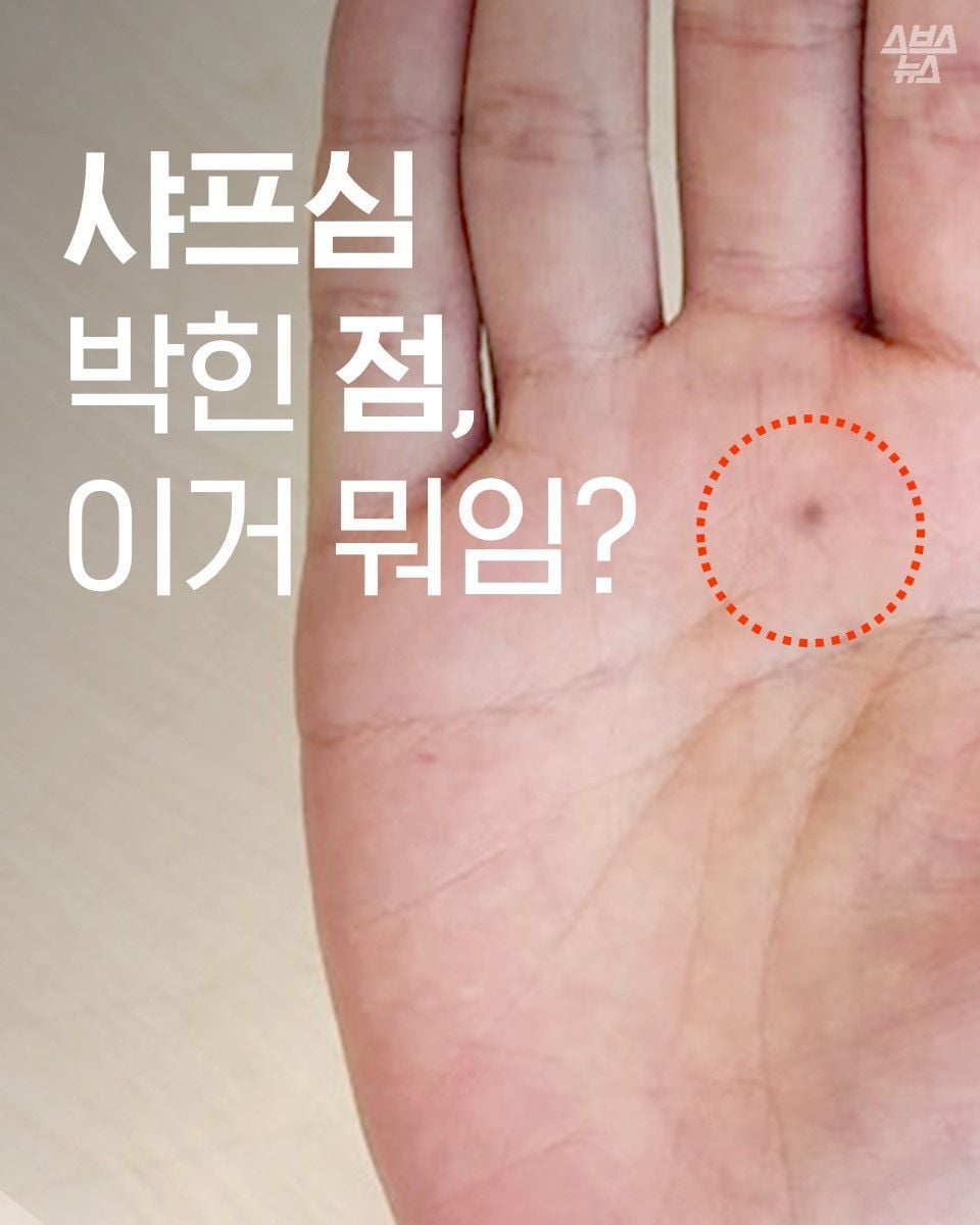 자기몸에 하나씩 있다는 연필심 점 | 인스티즈