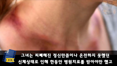 목 길이를 늘리기 위해 5년간 원주민들의 고리를 착용하고 다닌 미국인 | 인스티즈