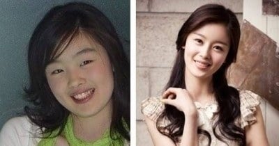 연예인 다이어트 전후 | 인스티즈