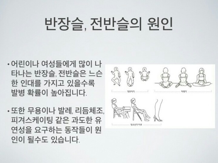 [반장슬] 다리모양 분명 이렇게 생긴 여시들 있을거야!(종아리가 뒤로 빠진 형태) | 인스티즈