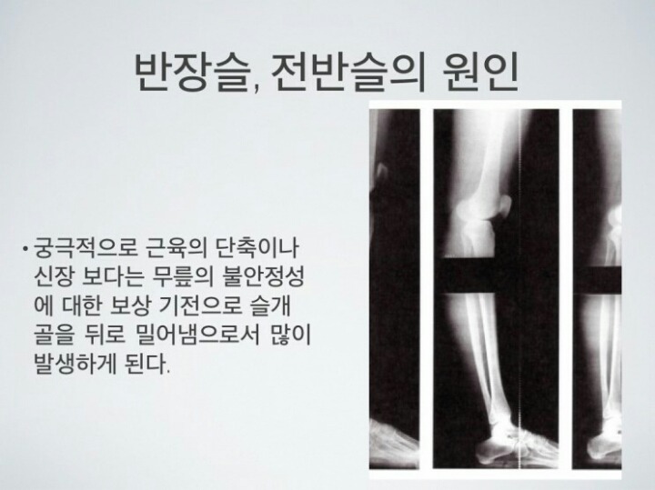 [반장슬] 다리모양 분명 이렇게 생긴 여시들 있을거야!(종아리가 뒤로 빠진 형태) | 인스티즈