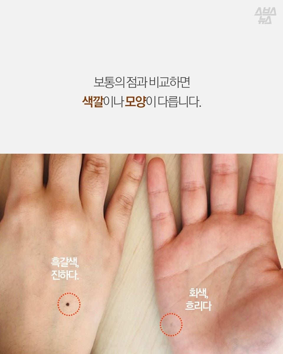 자기몸에 하나씩 있다는 연필심 점 | 인스티즈