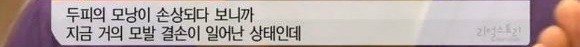 [리얼스토리눈] 15곳을 수술한 여자 내 얼굴을 찾아주세요 (성형수술 부작용) | 인스티즈