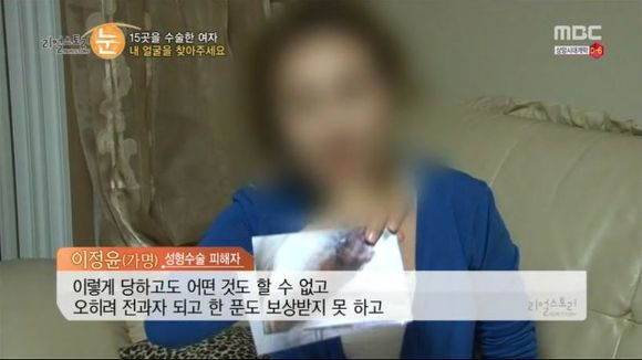 [리얼스토리눈] 15곳을 수술한 여자 내 얼굴을 찾아주세요 (성형수술 부작용) | 인스티즈