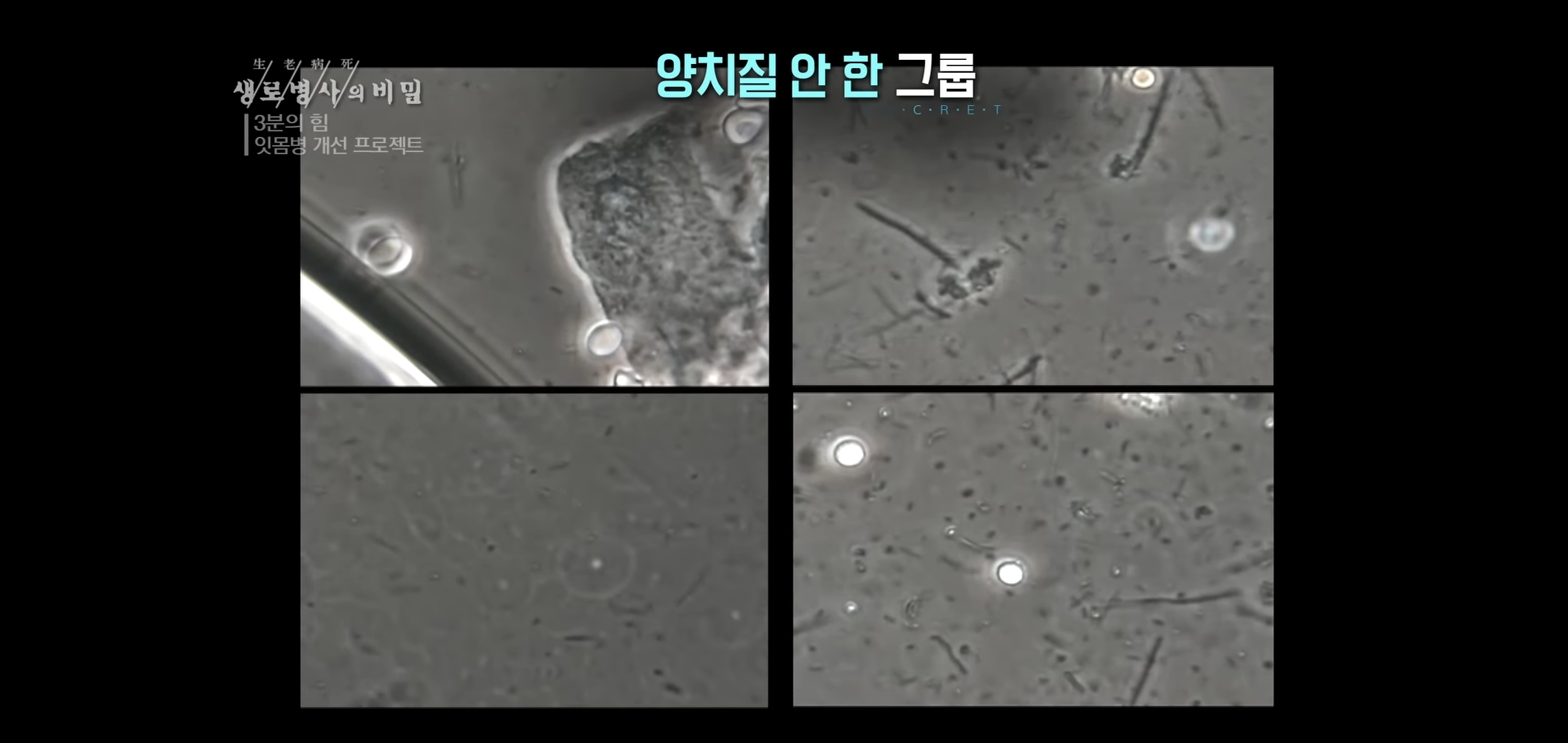 자기 직전에 양치질하는 사람들 충격적 실험 결과..jpg | 인스티즈