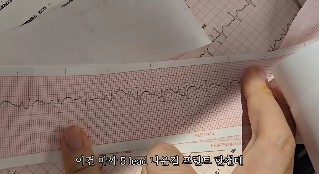 일하다가 심장마비 느낀 간호사 브이로그 | 인스티즈