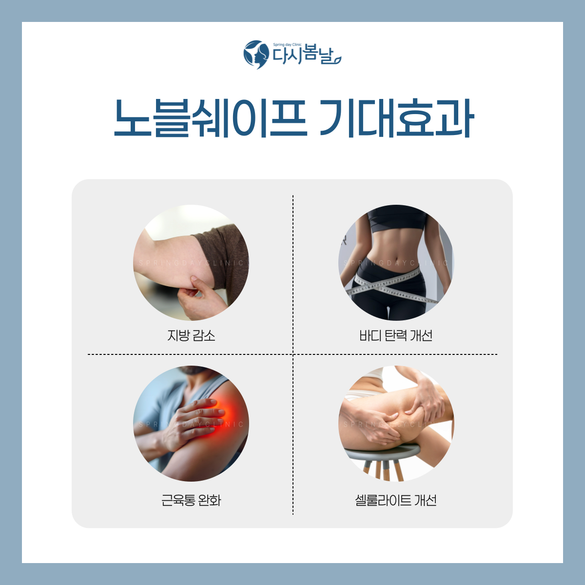 주사이모 고주파 기계 | 인스티즈