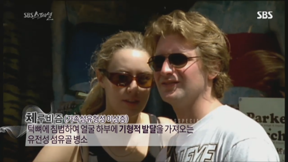 기형적 턱을 가진 여자 비키 라이트가 성형수술을 하지 않는 이유 | 인스티즈