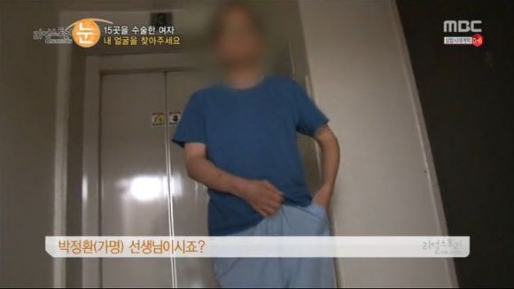 [리얼스토리눈] 15곳을 수술한 여자 내 얼굴을 찾아주세요 (성형수술 부작용) | 인스티즈