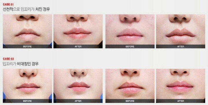 표정이 무뚝뚝하다는 소리를 많이 듣는 이유중 하나 | 인스티즈