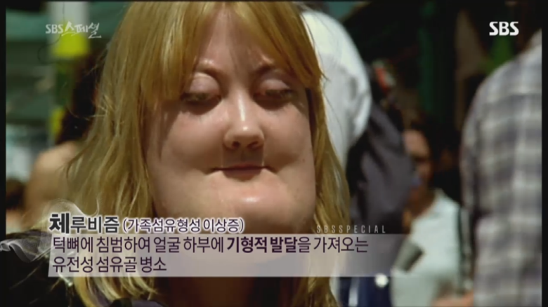 기형적 턱을 가진 여자 비키 라이트가 성형수술을 하지 않는 이유 | 인스티즈