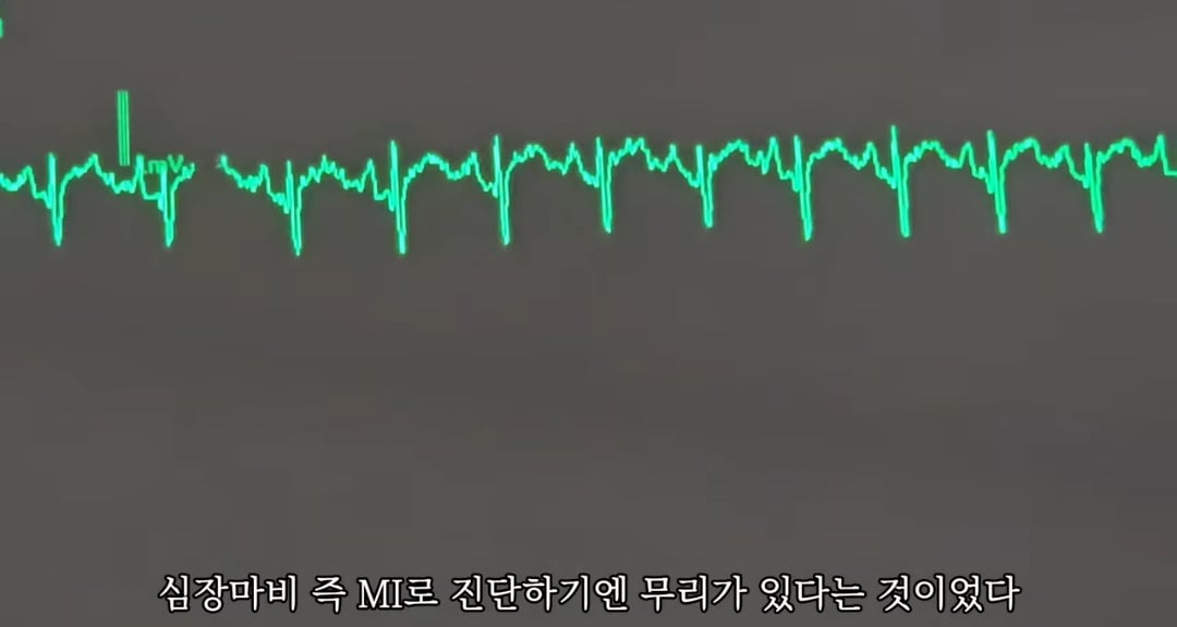 일하다가 심장마비 느낀 간호사 브이로그 | 인스티즈