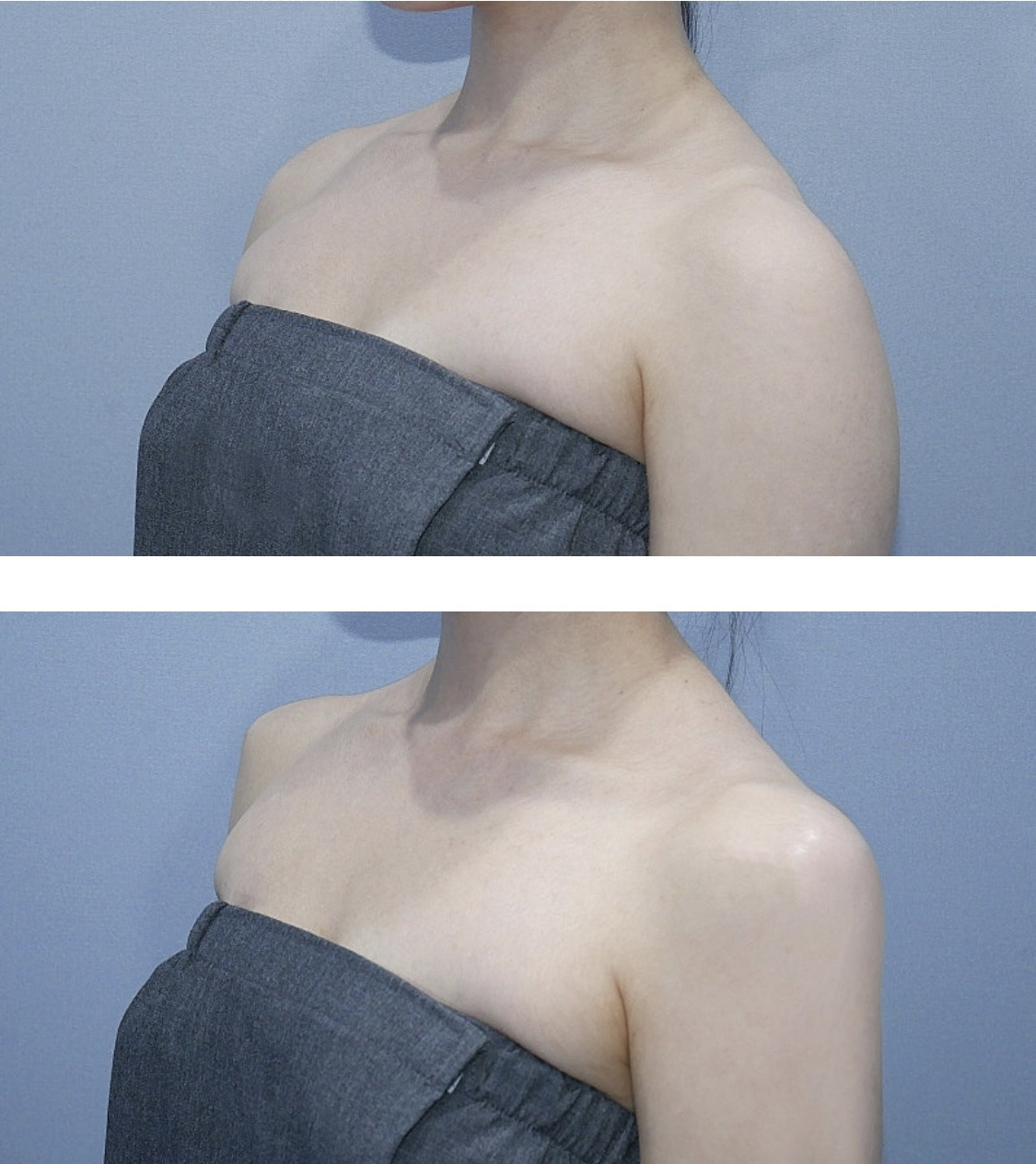 최근들어 직각어깨가 급 많아진 이유 (f.조두팔) | 인스티즈