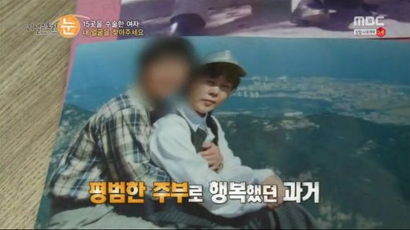 [리얼스토리눈] 15곳을 수술한 여자 내 얼굴을 찾아주세요 (성형수술 부작용) | 인스티즈