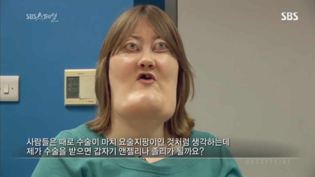 기형적 턱을 가진 여자 비키 라이트가 성형수술을 하지 않는 이유 | 인스티즈