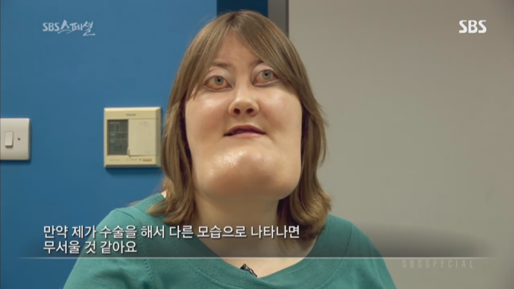 기형적 턱을 가진 여자 비키 라이트가 성형수술을 하지 않는 이유 | 인스티즈