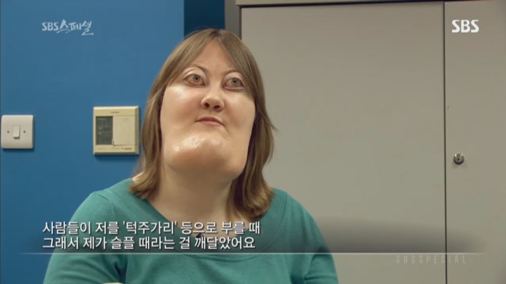 기형적 턱을 가진 여자 비키 라이트가 성형수술을 하지 않는 이유 | 인스티즈